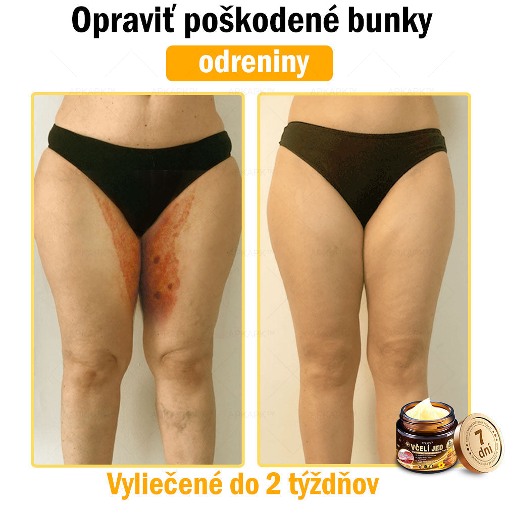 Zostalo už len 5 plechoviek! Ponúkame 50 % extra zľavu! Udržujte svoju pleť zdravú. Ak to teraz zmeškáte, budete mať šancu až budúci rok!