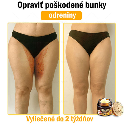 Zostalo už len 5 plechoviek! Ponúkame 50 % extra zľavu! Udržujte svoju pleť zdravú. Ak to teraz zmeškáte, budete mať šancu až budúci rok!