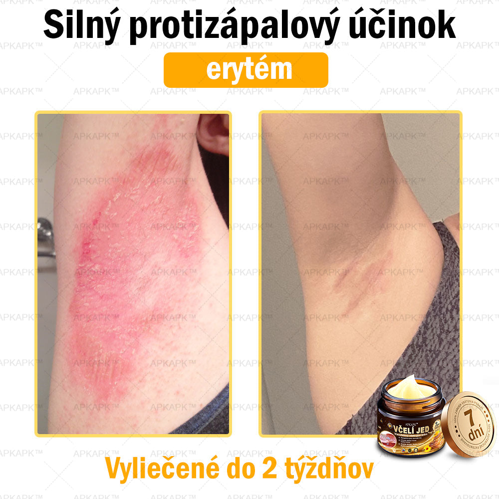 Zostalo už len 5 plechoviek! Ponúkame 50 % extra zľavu! Udržujte svoju pleť zdravú. Ak to teraz zmeškáte, budete mať šancu až budúci rok!