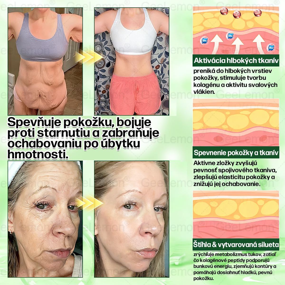 𝐆𝐞𝑒𝐿𝑒𝐦𝐨𝐧® 👩‍⚕️ Glumasetide 8 v 1 Nano mikrotŕňový náplasť – Len raz denne ✅ Viditeľné zmeny za 7 dní na obezitu, ochabnutú pokožku a zdravie