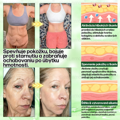 𝐆𝐞𝑒𝐿𝑒𝐦𝐨𝐧® 👩‍⚕️ Glumasetide 8 v 1 Nano mikrotŕňový náplasť – Len raz denne ✅ Viditeľné zmeny za 7 dní na obezitu, ochabnutú pokožku a zdravie