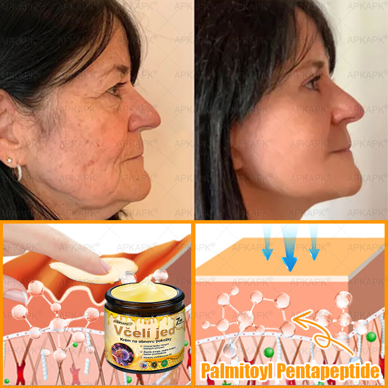 ⏰Zostáva už len 5 balení na sklade! Ponúkame dodatočnú zľavu 30 %! Zdravšie telo je na dosah! Ak to teraz premeškáte, budete musieť na ďalšiu príležitosť počkať až do budúceho roka!⏰𝖠𝖯𝖪𝖠𝖯𝖪®