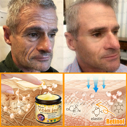 ⏰Zostáva už len 5 balení na sklade! Ponúkame dodatočnú zľavu 30 %! Zdravšie telo je na dosah! Ak to teraz premeškáte, budete musieť na ďalšiu príležitosť počkať až do budúceho roka!⏰𝖠𝖯𝖪𝖠𝖯𝖪®