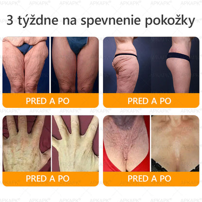 ⏰Zostáva už len 5 balení na sklade! Ponúkame dodatočnú zľavu 30 %! Zdravšie telo je na dosah! Ak to teraz premeškáte, budete musieť na ďalšiu príležitosť počkať až do budúceho roka!⏰𝖠𝖯𝖪𝖠𝖯𝖪®