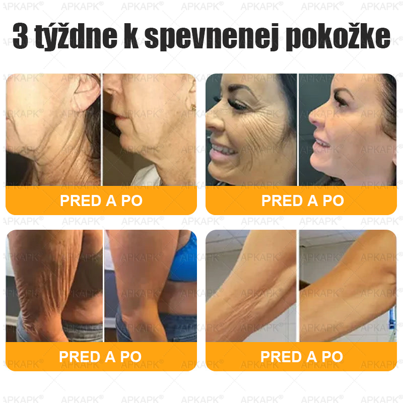 ⏰Zostáva už len 5 balení na sklade! Ponúkame dodatočnú zľavu 30 %! Zdravšie telo je na dosah! Ak to teraz premeškáte, budete musieť na ďalšiu príležitosť počkať až do budúceho roka!⏰𝖠𝖯𝖪𝖠𝖯𝖪®