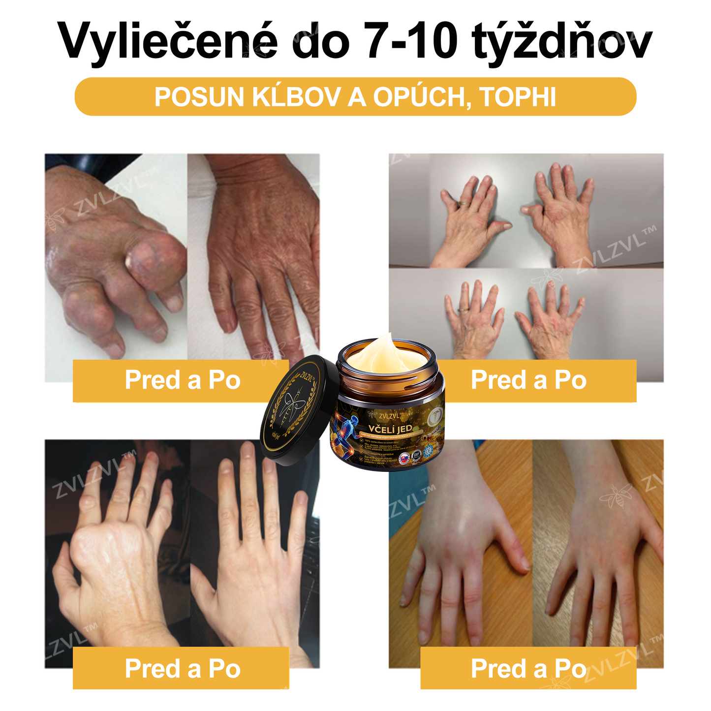 𝐙𝐕𝐋𝐙𝐕𝐋™  𝐕č𝐞𝐥í 𝐣𝐞𝐝 𝐨𝐤𝐚𝐦ž𝐢𝐭ý 𝐮𝐥𝐭𝐫𝐚 𝐬𝐢𝐥𝐧ý 𝐤𝐫é𝐦 𝐩𝐫𝐨𝐭𝐢 𝐛𝐨𝐥𝐞𝐬𝐭𝐢 - (𝐳𝐦𝐢𝐞𝐫ň𝐮𝐣𝐞 𝐛𝐨𝐥𝐞𝐬ť 𝐩𝐫𝐢 𝐚𝐫𝐭𝐫𝐢𝐭í𝐝𝐞, 𝐛𝐨𝐥𝐞𝐬𝐭𝐢 𝐬𝐯𝐚𝐥𝐨𝐯, 𝐜𝐡𝐫𝐛𝐭𝐚, 𝐤𝐨𝐥𝐢𝐞𝐧, 𝐜𝐡𝐫𝐛𝐭𝐚, 𝐫𝐚𝐦𝐢𝐞𝐧, 𝐛𝐨𝐤𝐨𝐯, 𝐳á𝐩ä𝐬𝐭í, 𝐫ú𝐤)