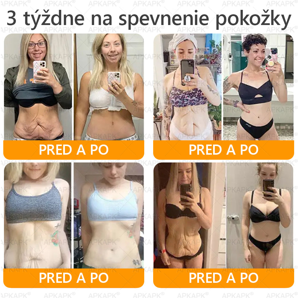 ⏰Zostáva už len 5 balení na sklade! Ponúkame dodatočnú zľavu 30 %! Zdravšie telo je na dosah! Ak to teraz premeškáte, budete musieť na ďalšiu príležitosť počkať až do budúceho roka!⏰𝖠𝖯𝖪𝖠𝖯𝖪®