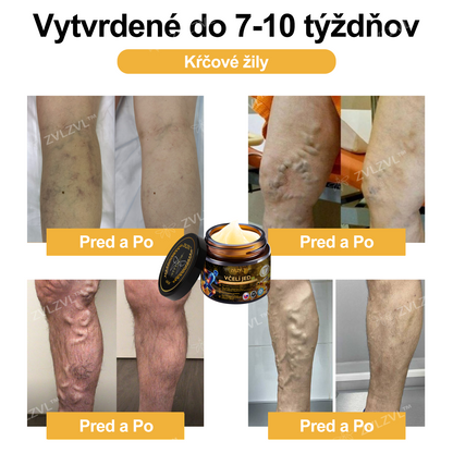 𝐙𝐕𝐋𝐙𝐕𝐋™  𝐕č𝐞𝐥í 𝐣𝐞𝐝 𝐨𝐤𝐚𝐦ž𝐢𝐭ý 𝐮𝐥𝐭𝐫𝐚 𝐬𝐢𝐥𝐧ý 𝐤𝐫é𝐦 𝐩𝐫𝐨𝐭𝐢 𝐛𝐨𝐥𝐞𝐬𝐭𝐢 - (𝐳𝐦𝐢𝐞𝐫ň𝐮𝐣𝐞 𝐛𝐨𝐥𝐞𝐬ť 𝐩𝐫𝐢 𝐚𝐫𝐭𝐫𝐢𝐭í𝐝𝐞, 𝐛𝐨𝐥𝐞𝐬𝐭𝐢 𝐬𝐯𝐚𝐥𝐨𝐯, 𝐜𝐡𝐫𝐛𝐭𝐚, 𝐤𝐨𝐥𝐢𝐞𝐧, 𝐜𝐡𝐫𝐛𝐭𝐚, 𝐫𝐚𝐦𝐢𝐞𝐧, 𝐛𝐨𝐤𝐨𝐯, 𝐳á𝐩ä𝐬𝐭í, 𝐫ú𝐤)