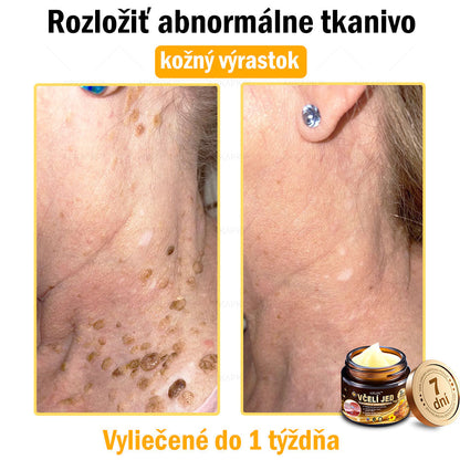 Zostalo už len 5 plechoviek! Ponúkame 50 % extra zľavu! Udržujte svoju pleť zdravú. Ak to teraz zmeškáte, budete mať šancu až budúci rok!