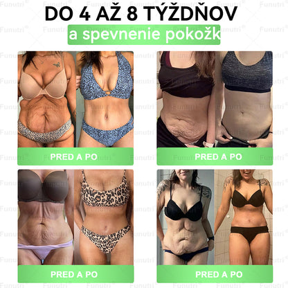 𝐎𝐟𝐢𝐜𝐢á𝐥𝐧𝐲 𝐨𝐛𝐜𝐡𝐨𝐝 ✨ Funutri® 10 v 1 metabolická formujúca náplasť s nano mikroihličkami (𝐒𝐭𝐚čí 𝐫𝐚𝐳 𝐝𝐞𝐧𝐧𝐞, 𝐯𝐢𝐝𝐢𝐭𝐞ľ𝐧é 𝐳𝐦𝐞𝐧𝐲 𝐮ž 𝐳𝐚 𝟕 𝐝𝐧í)