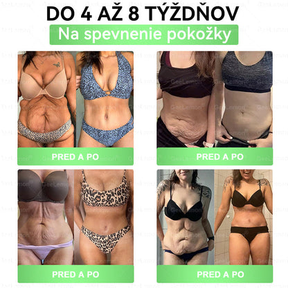 𝐆𝐞𝑒𝐿𝑒𝐦𝐨𝐧® 👩‍⚕️ Glumasetide 8 v 1 Nano mikrotŕňový náplasť – Len raz denne ✅ Viditeľné zmeny za 7 dní na obezitu, ochabnutú pokožku a zdravie