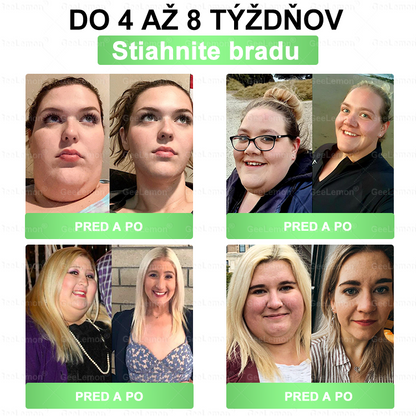 𝐆𝐞𝑒𝐿𝑒𝐦𝐨𝐧® 👩‍⚕️ Glumasetide 8 v 1 Nano mikrotŕňový náplasť – Len raz denne ✅ Viditeľné zmeny za 7 dní na obezitu, ochabnutú pokožku a zdravie